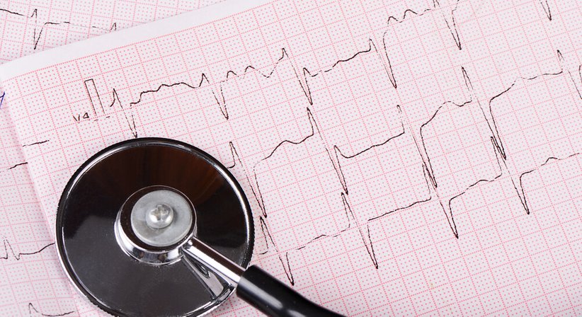 EKG (Elektrokardiografie) - Dr. Tina Windschnurer - Internistin Wien 1220
