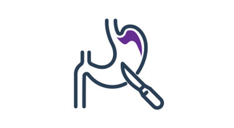 Refluxchirurgie - Prof.Dr. Michael Rogy - Allgemeinchirurg Wien 1020