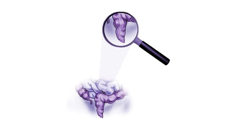 Rektoskopie - Prof.Dr. Michael Rogy - Allgemeinchirurg Wien 1020