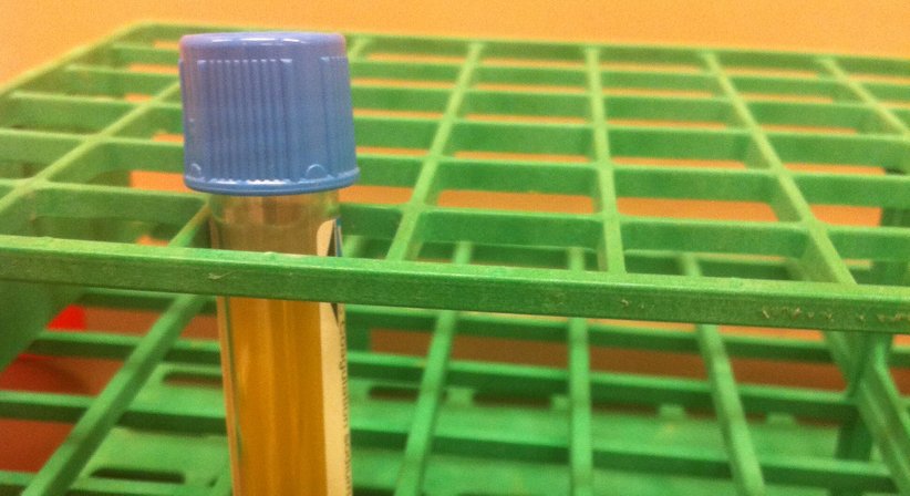 Medizinsches Abnehmen - Ao.Univ.Prof. Dr. Peter Frigo - Frauenarzt Wien 1010