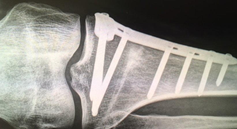 Kniegelenkschirugie - OA Dr. Andreas Mondl - Unfallchirurg Wien 1220