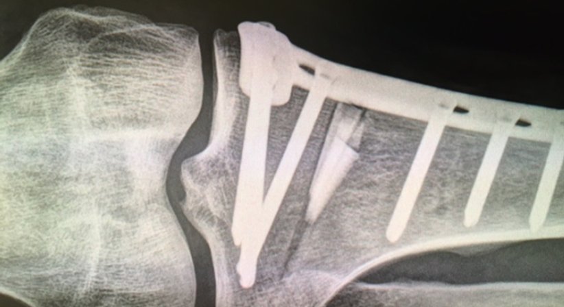 Kniegelenkschirugie - OA Dr. Andreas Mondl - Unfallchirurg Wien 1220