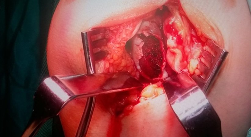 Kniegelenkschirugie - OA Dr. Andreas Mondl - Unfallchirurg Wien 1220