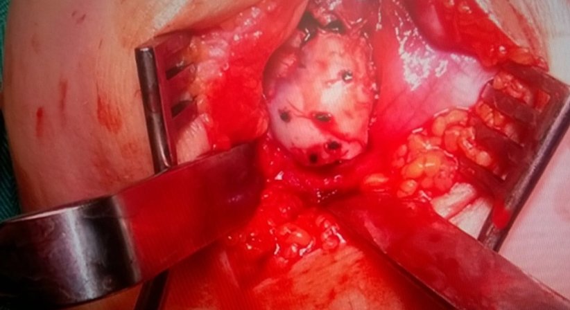 Kniegelenkschirugie - OA Dr. Andreas Mondl - Unfallchirurg Wien 1220