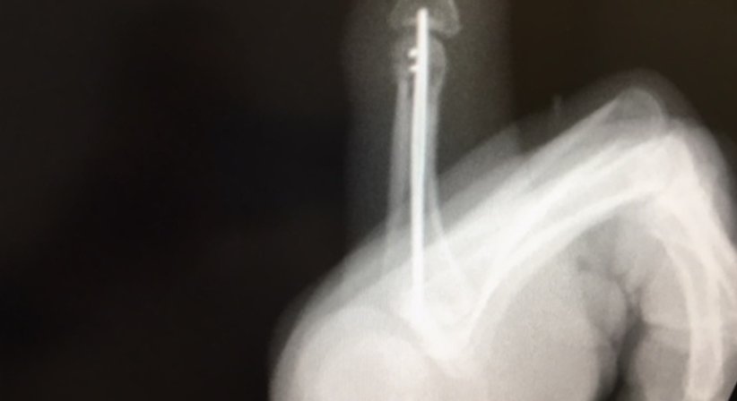 Osteosynthesen - OA Dr. Andreas Mondl - Unfallchirurg Wien 1220