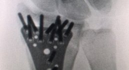 OA Dr. Andreas Mondl - Unfallchirurg Wien 1220