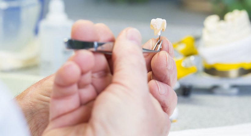 Inlays / Onlays - DDr. Wolfgang Seemann - Zahnarzt Wien 1150