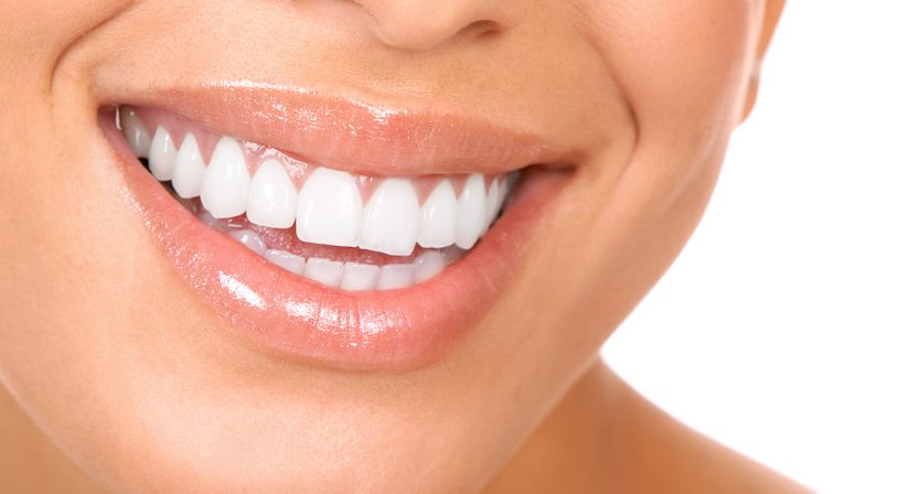 Unsichtbare Zahnspange - DDr. Wolfgang Seemann - Zahnarzt Wien 1150