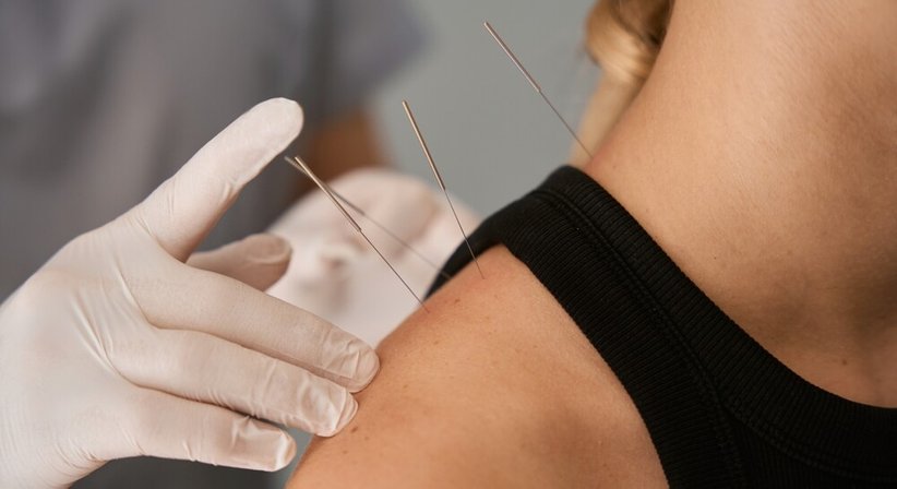 Akupunktur - Dr. Michaela Beham-Kacerovsky, PhD MSc - Anästhesistin Wien 1170