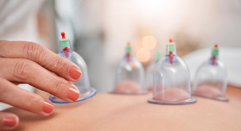 Schröpfen - Dr. Michaela Beham-Kacerovsky, PhD MSc - Anästhesistin Wien 1170