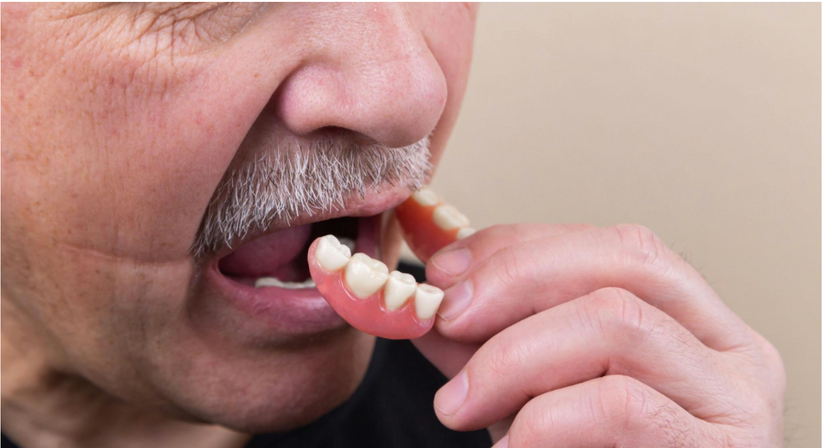 Prothetik / Zahnersatz - Dr. Sarah Abdel-Hamied - Zahnärztin Gänserndorf 2230