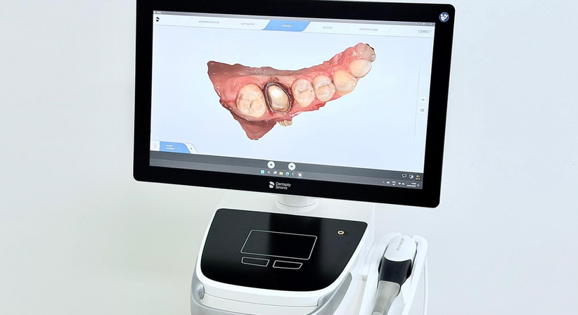 Digitaler 3D-Oralscanner (Abdruckfreie Behandlung) - Dr. Sarah Abdel-Hamied - Zahnärztin Gänserndorf 2230