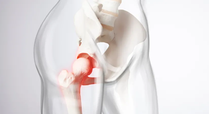 Gelenkerhaltende Hüftchirurgie
