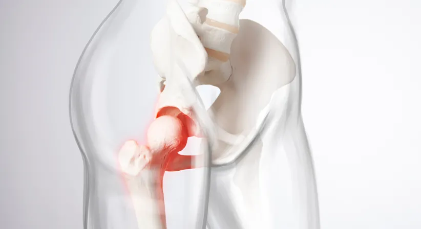Gelenkerhaltende Hüftchirurgie - Dr. med. Wolfgang Zinser, Prim. a. D. - Orthopäde Knittelfeld 8720