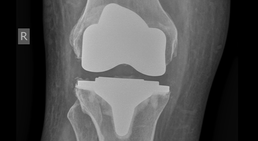 Dr. med. Wolfgang Zinser, Prim. a. D. - Orthopäde Knittelfeld 8720