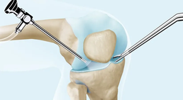 Dr. med. Wolfgang Zinser, Prim. a. D. - Orthopäde Knittelfeld 8720