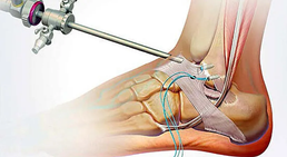 Dr. med. Wolfgang Zinser, Prim. a. D. - Orthopäde Knittelfeld 8720