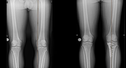 Dr. med. Wolfgang Zinser, Prim. a. D. - Orthopäde Knittelfeld 8720