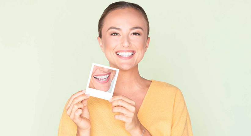 Festsitzende Zahnspangen mit Brackets - Klinik Professor Jonke -  Wien 1070