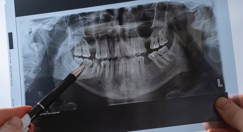 Röntgenaufnahme, Abdrucknahme und Fotografie - Dr. med. dent. Hadi Dehghani, MSc - Schwerpunkt: Kieferorthopädie Pfarrwerfen 5452