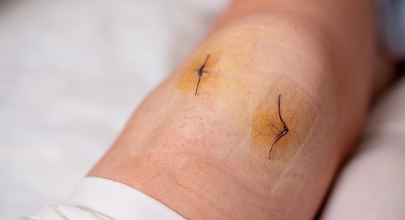 Knie Arthroskopie - OA Ing. Dr. med. Benjamin Schett - Orthopäde Wien 1010