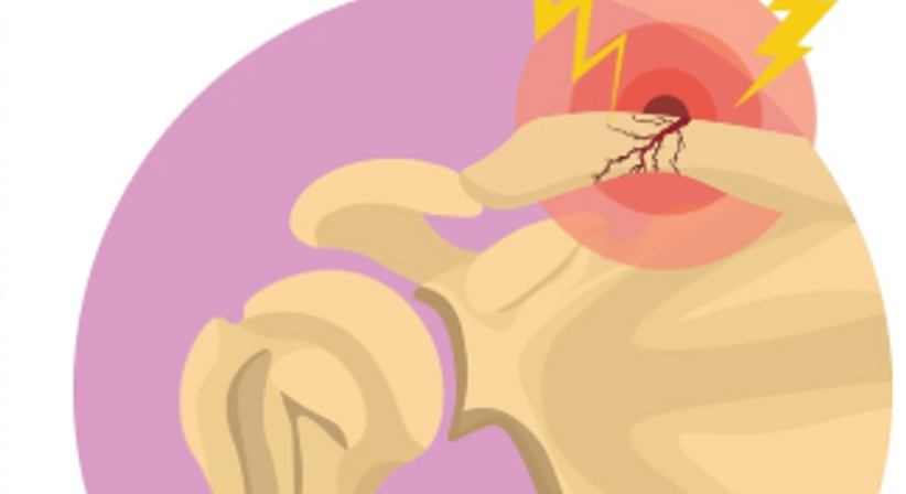 Frakturen (Scapula, Humeruskopf) - OA Ing. Dr. med. Benjamin Schett - Orthopäde Wien 1010