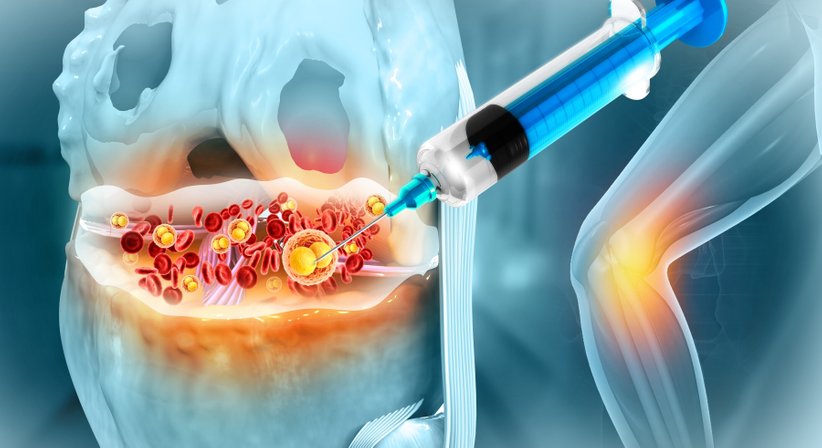 Knorpeldefekte - OA Ing. Dr. med. Benjamin Schett - Orthopäde Wien 1010