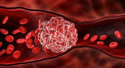 Abklärung von Blutungsstörungen