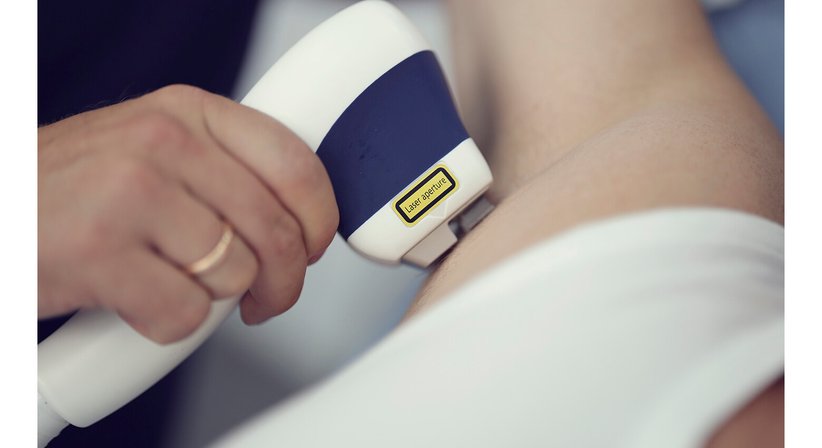 Laser Haarentfernung - Dr. Kaan Harmankaya - Hautarzt Wien 1010