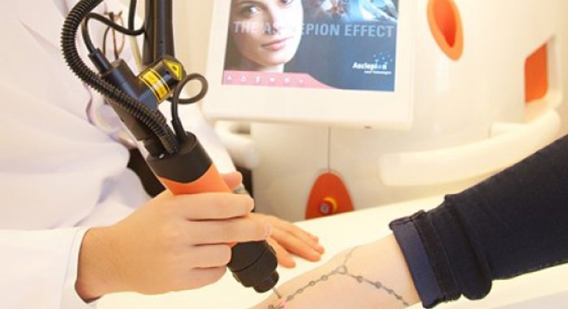 Laser Tattoo Entfernung - Dr. Kaan Harmankaya - Hautarzt Wien 1010