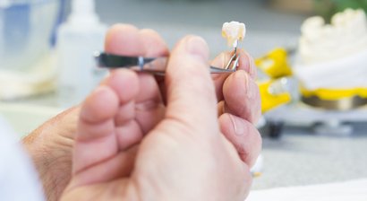 Inlay / Onlay / Overlay