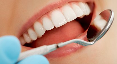 Professionelle Mundhygiene