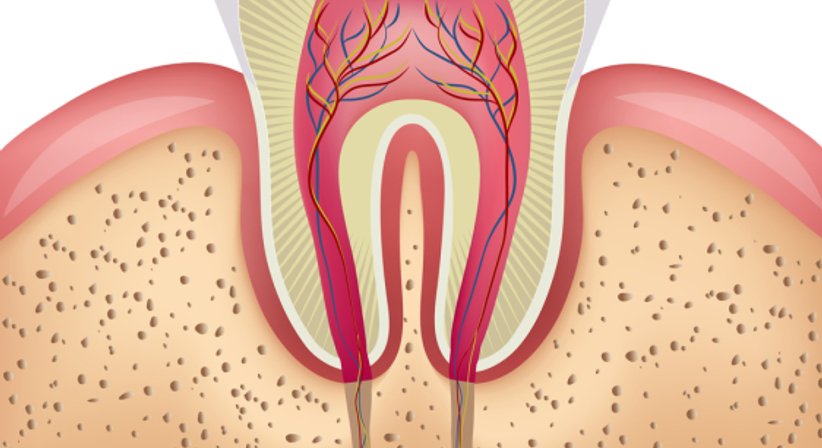 Wurzelspitzenresektion - Dr. med.dent. Jochen Leidl - Zahnarzt Mattersburg 7210
