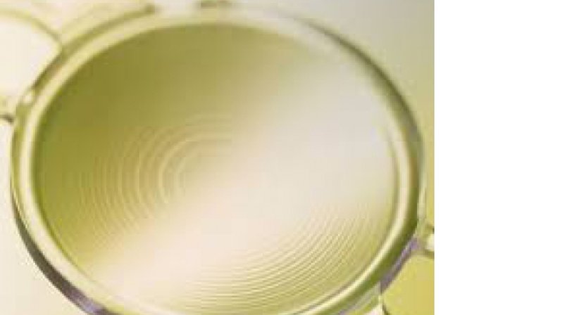 Refraktiver Linsentauschauch - Dr. Matthias Maus - Augenarzt Wien 1010