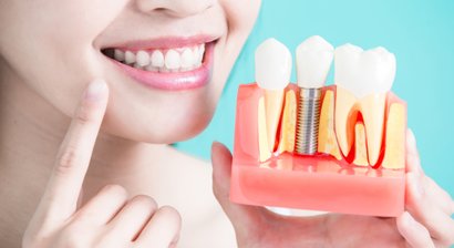 Implantate / Knochenaufbau