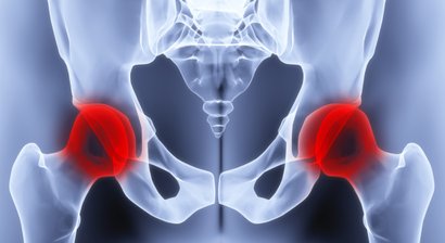 Arthrose / Gelenksabnützung