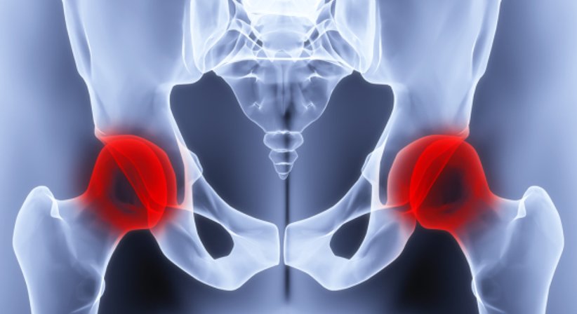 Arthrose / Gelenksabnützung - OA Dr. Delio Peter Pramhas - Orthopäde Wien 1060
