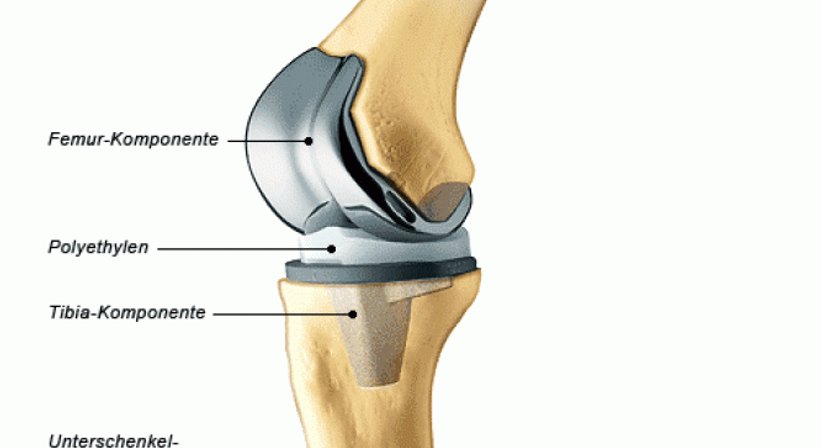 Chirurgische Orthopädie - OA Dr. Delio Peter Pramhas - Orthopäde Wien 1060