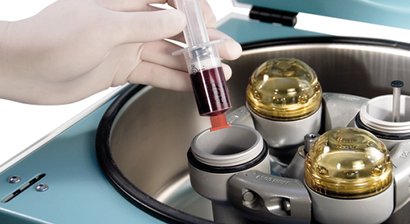 Eigenbluttherapie / PRP