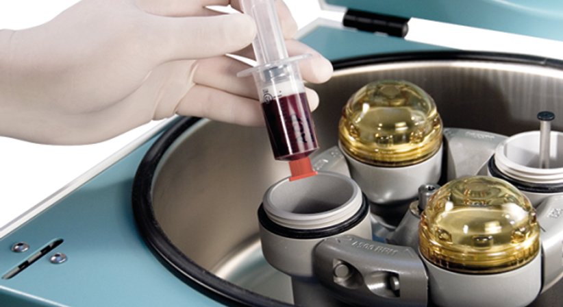 Eigenbluttherapie / PRP - OA Dr. Delio Peter Pramhas - Orthopäde Wien 1060