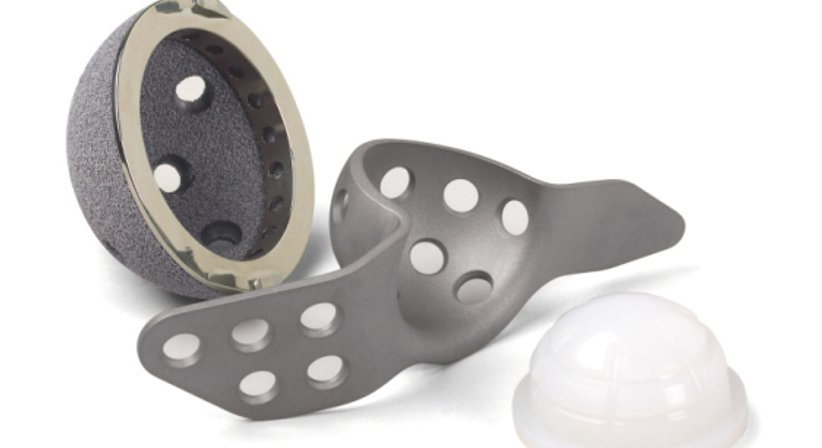 Wechseleingriffe nach Knie- und Hüftprothesen - OA Dr. Delio Peter Pramhas - Orthopäde Wien 1060