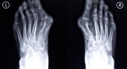 Univ.Doz. Dr. Martin Buchelt - Orthopäde Wien 1190