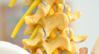 Wirbelsäulenchirurgie