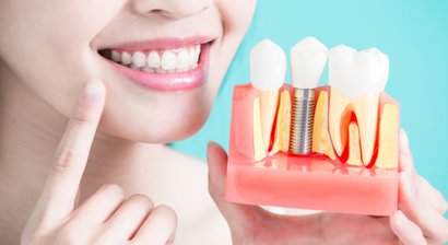 Implantate / Knochenaufbau