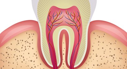 Chirurgie (Wurzelspitzenresektionen - Weisheitszähne- Knochenaufbau)