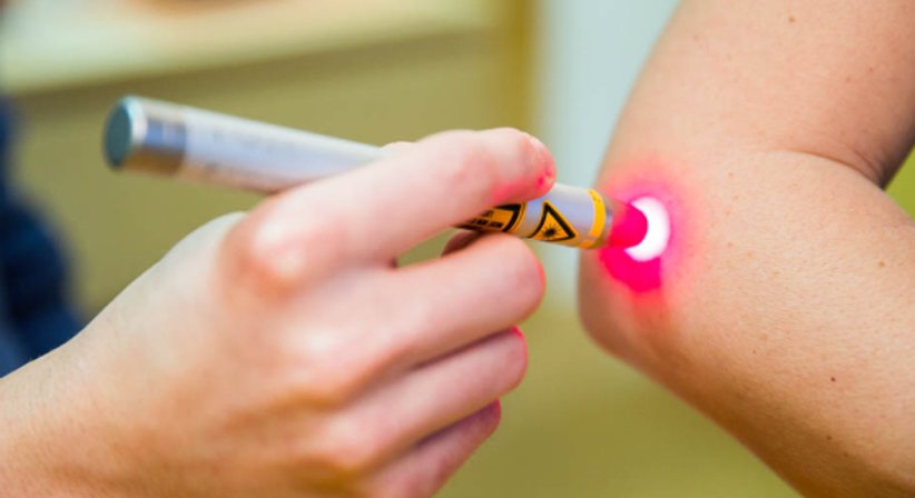 Lasertherapie (Softlaser) - Dr. Bernhard Gisinger - Orthopäde Wien 1220