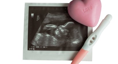 NIPT- Harmony oder Panorama Test