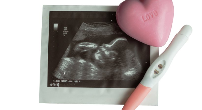 NIPT- Harmony oder Panorama Test - Dr. Thomas Douschan - Frauenarzt Wien 1020