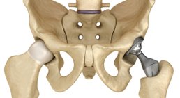 Assoc.-Prof. Priv.-Doz. Dr. Marcus Hofbauer - Unfallchirurg Wien 1190