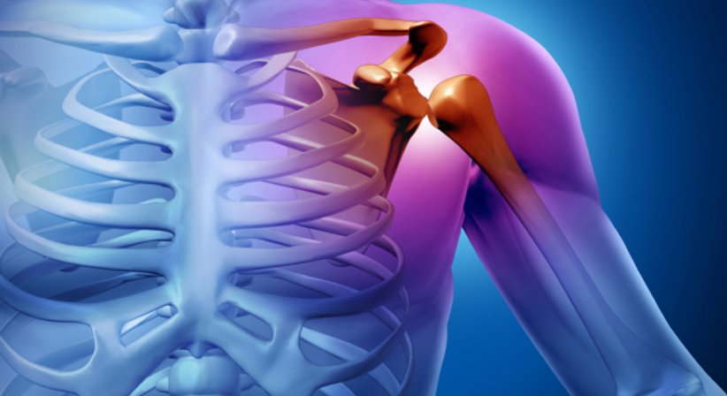 Schulterluxation - Assoc.-Prof. Priv.-Doz. Dr. Marcus Hofbauer - Unfallchirurg Wien 1190